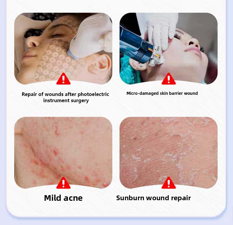 Facial chitosan wound dressing. Hydrating and moisturizing mask to prevent skin aging (5 pieces/box)