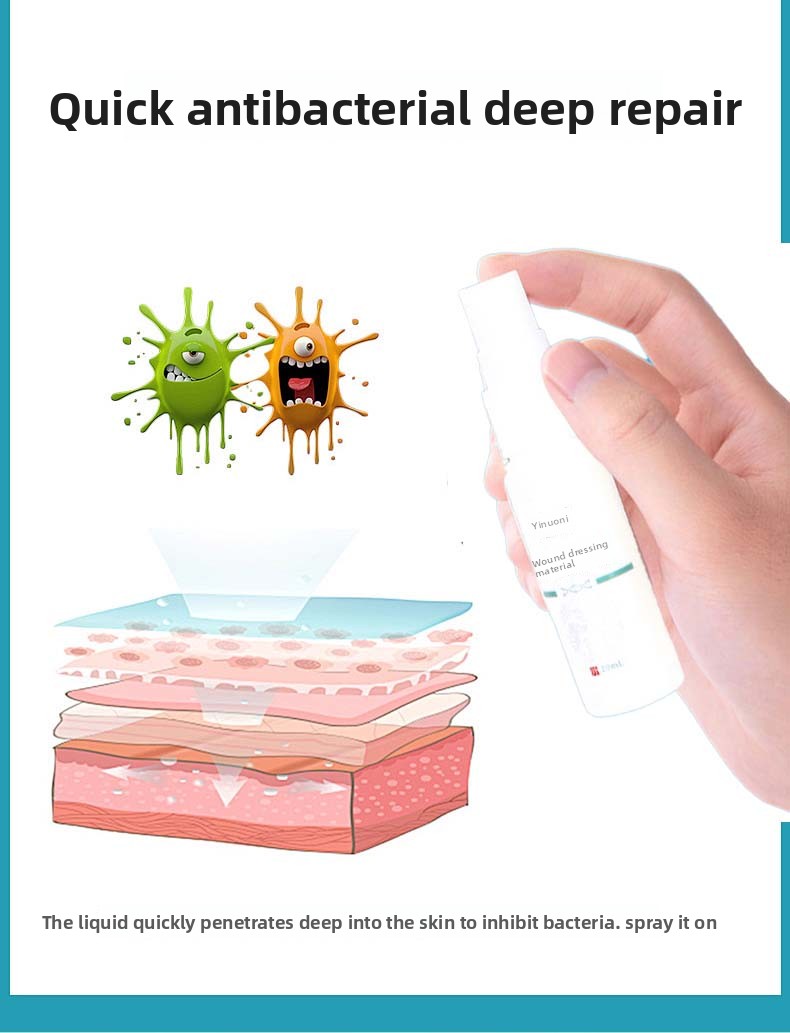 Skin-friendly sterile spray wound dressing for cuts, scrapes, lacerations, and burns. 30-second curing film, waterproof and quick-drying, for medical wound dressings for home use.