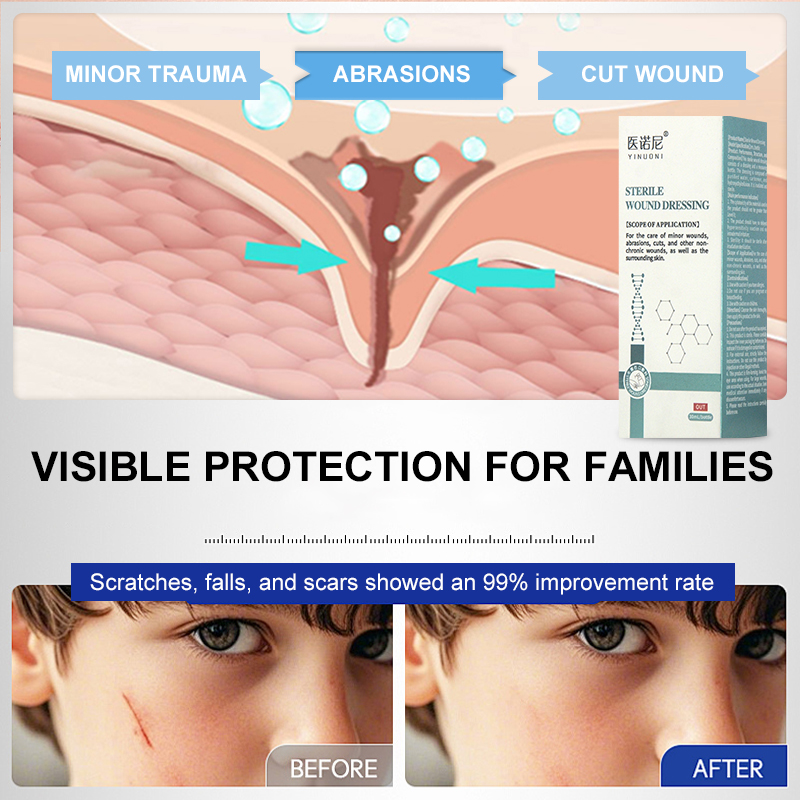 Skin-friendly sterile spray wound dressing for cuts, scrapes, lacerations, and burns. 30-second curing film, waterproof and quick-drying, for medical wound dressings for home use.