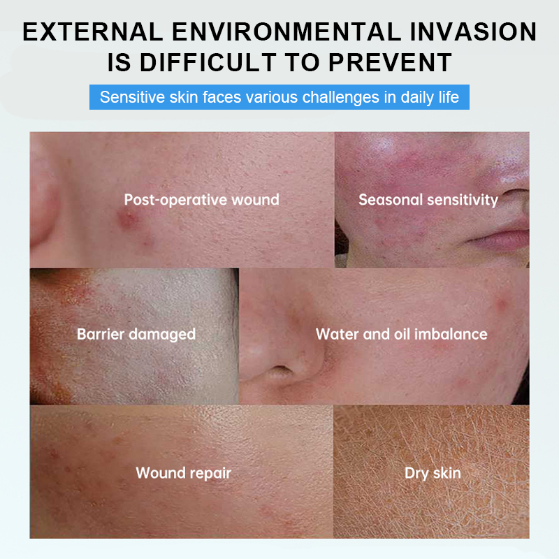 Sterile medical skin care dressings for abrasions/tears, postoperative wound healing and repair (5 dressings/box)