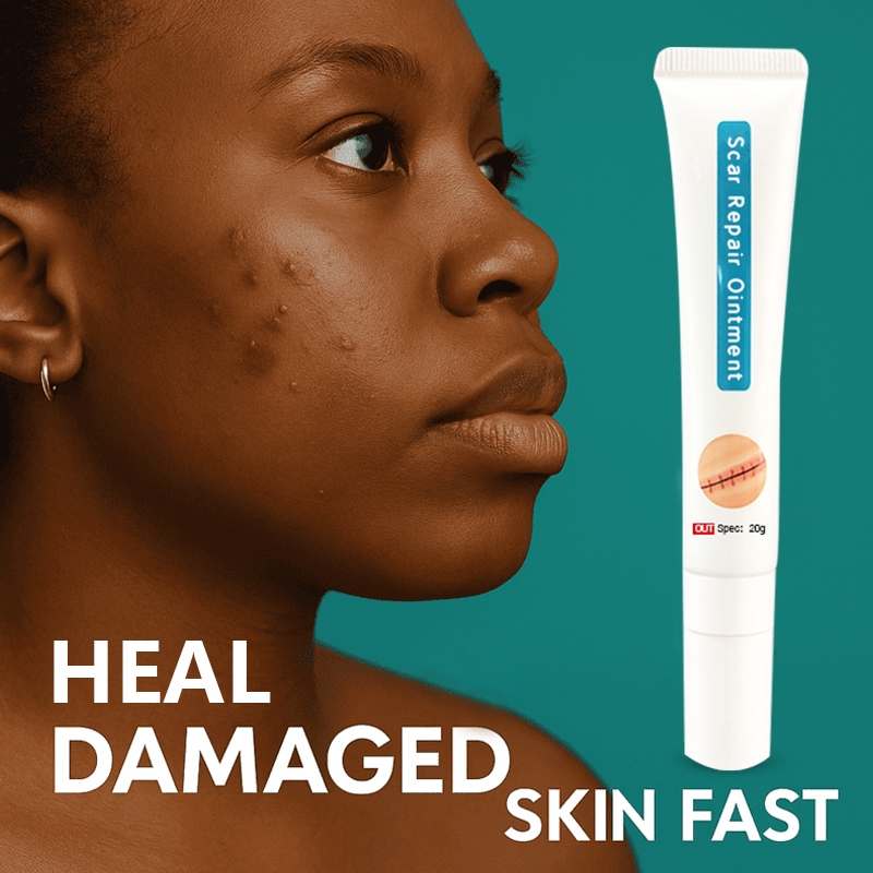 This medical-grade scar repair cream can repair acne scars, atrophic scars, stretch marks, pigmentation scars, surgical scars, burn scars, and more. Suitable for all skin types!