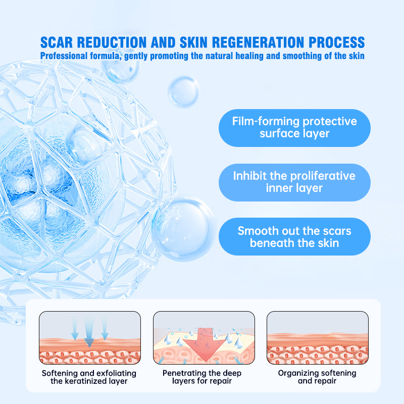 This medical-grade scar repair cream can repair acne scars, atrophic scars, stretch marks, pigmentation scars, surgical scars, burn scars, and more. Suitable for all skin types!