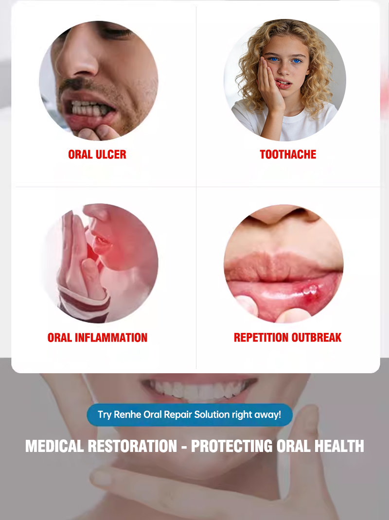 Renhe Medical Oral Repair Solution is suitable for relieving inflammation and pain, and treating blistering caused by internal heat.
